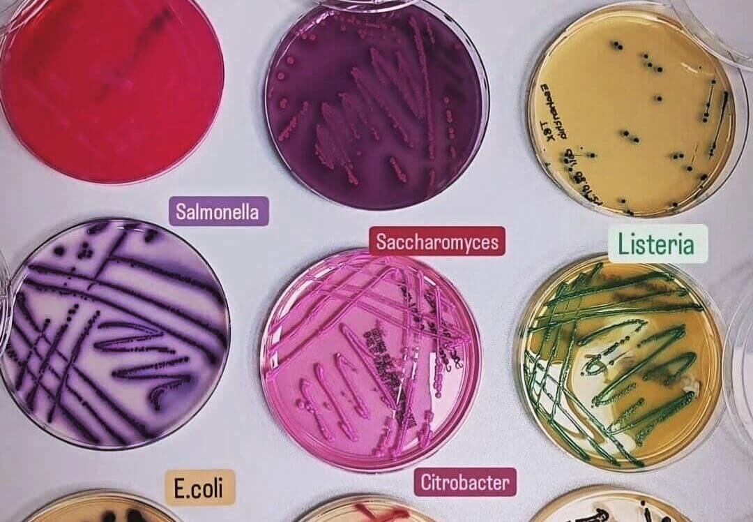 Lee más sobre el artículo Microbiología: ciencia clave para la salud y el desarrollo