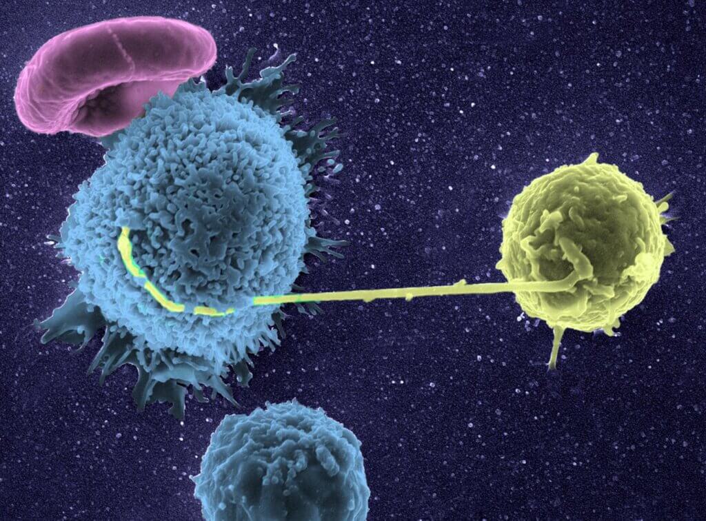 La ciencia avanza en los tratamientos contra el VIH