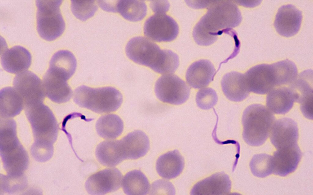 Ministra Gabriela Jiménez Ramírez valora investigaciones sobre Trypanosoma cruzi y la enfermedad de Chagas en Venezuela