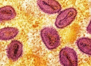 Lee más sobre el artículo <em>OMS declara el brote de viruela símica como emergencia de salud pública</em>