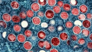 Lee más sobre el artículo Venezuela garantiza medidas sanitarias para la prevención de la viruela del mono