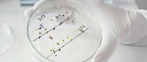 Lee más sobre el artículo Investigación alerta sobre incremento de la resistencia a los antimicrobianos en el mundo