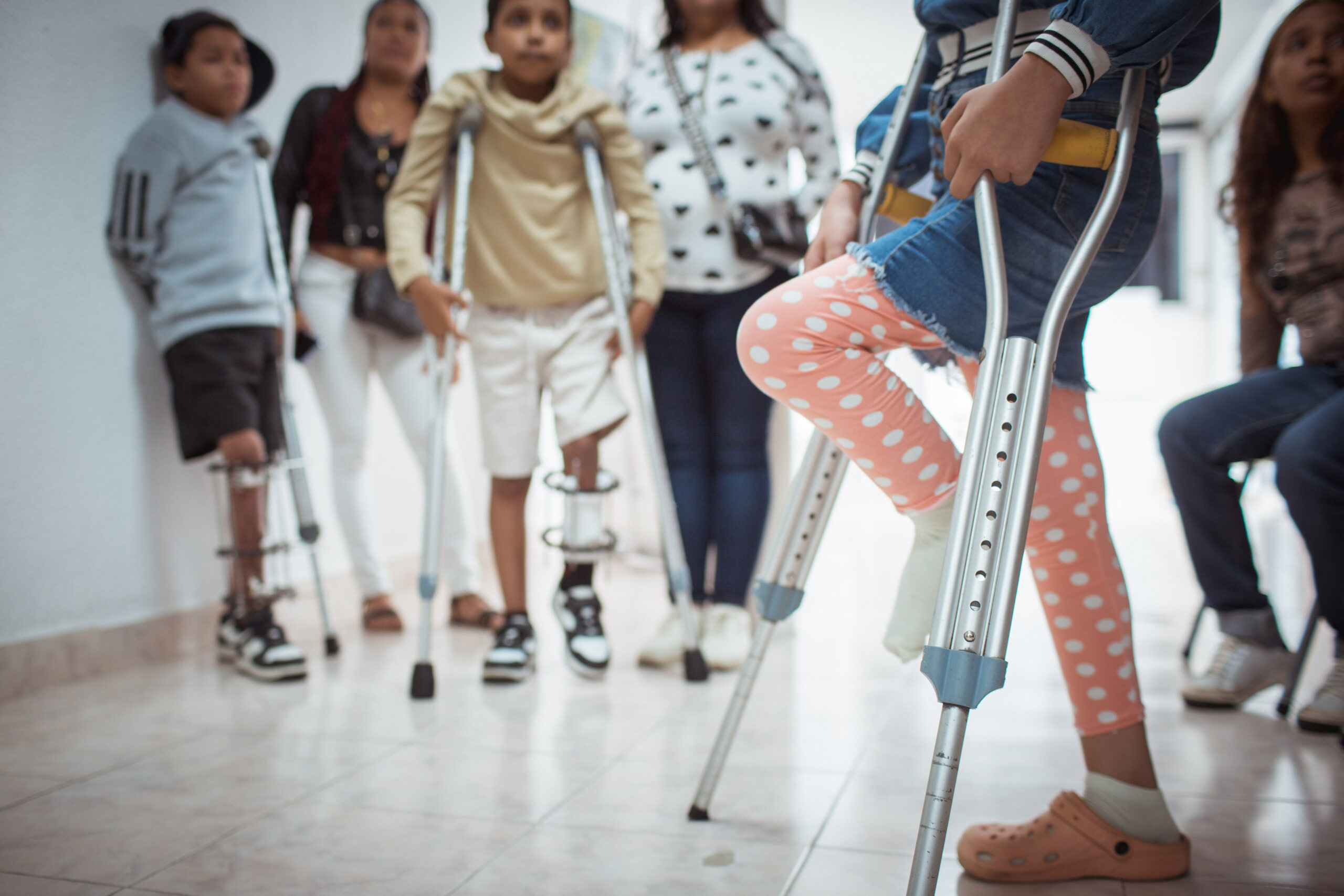 Lee más sobre el artículo Niños con pseudoartrosis congénita tratados con células madre evolucionan satisfactoriamente